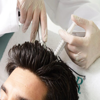 Hair mesotherapy