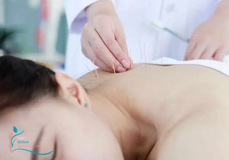 عوارض وحشتناک لیزر موهای زائد 5 عوارض لیزر موهای زائد از نظر طب سنتی