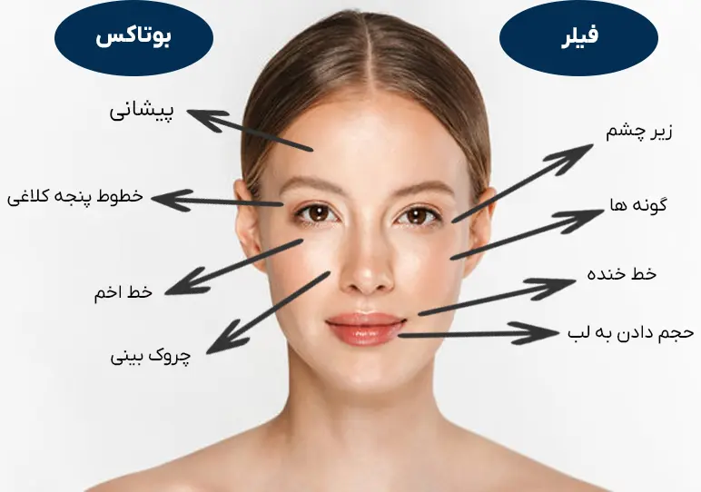 تزریق فیلر بهتره یا بوتاکس