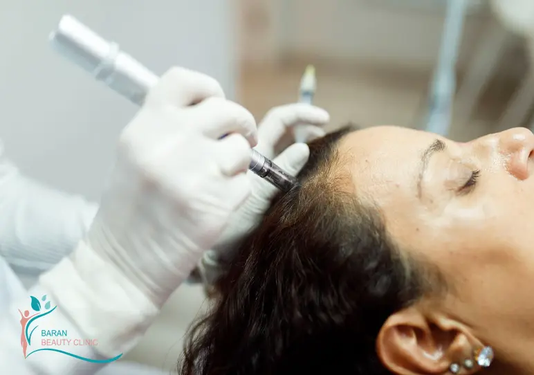 میکرونیدلینگ در رشت 1 بهترین دکتر میکرونیدلینگ در رشت و گیلان