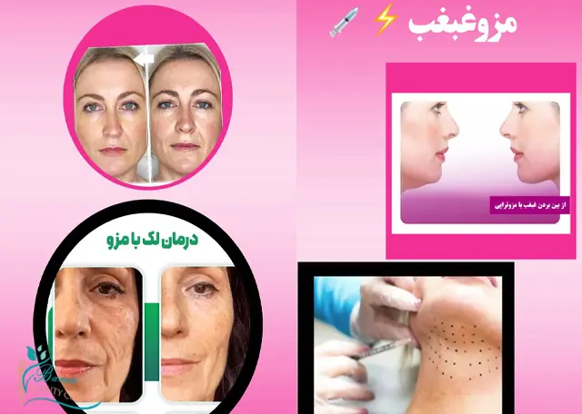 بهترین کلینیک مزوتراپی در رشت